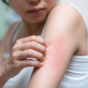 Das Geheimnis gesunder Haut? Milliarden kleiner Helfer